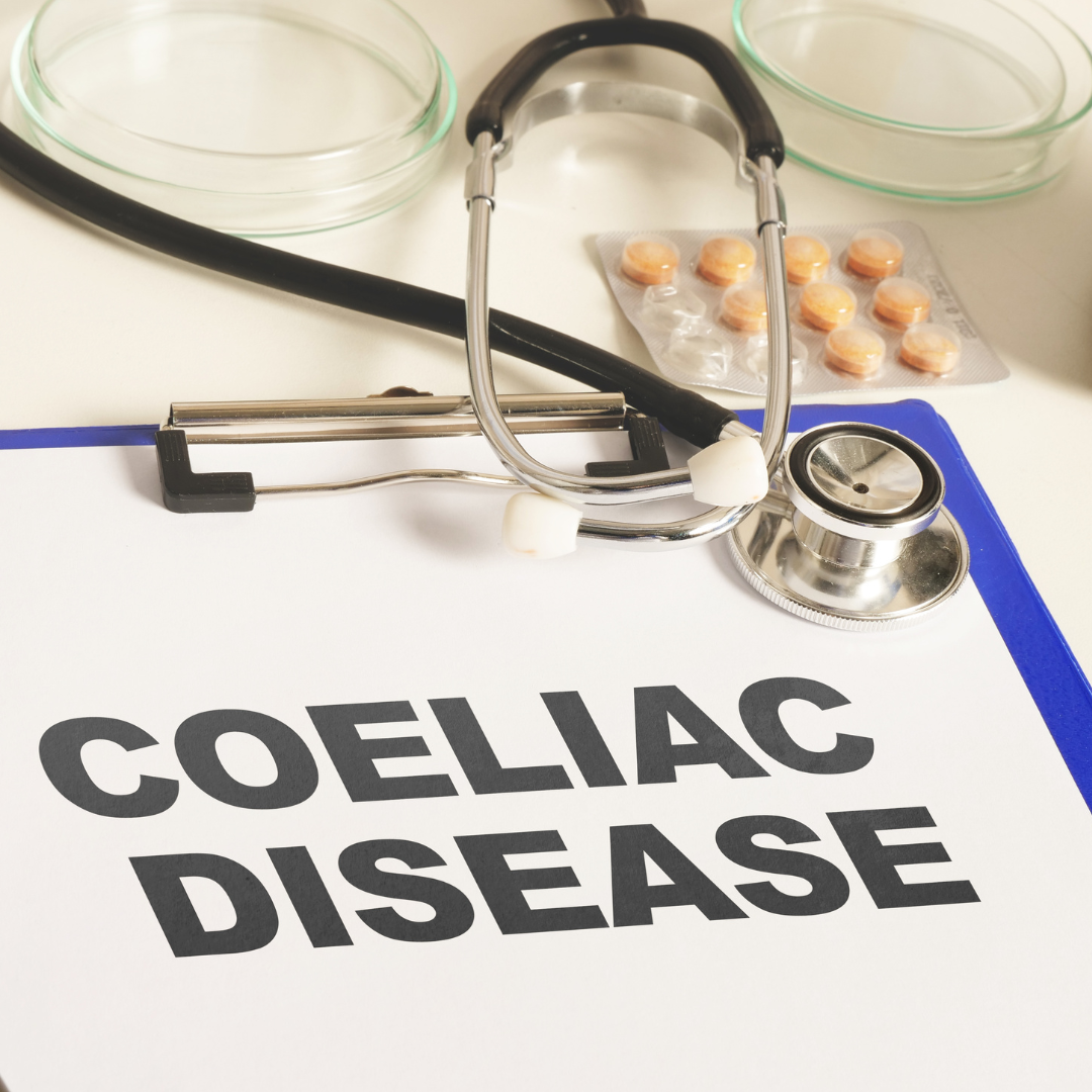 The Complex Relationship Between Coeliac Disease and IBS: A Diagnostic Dilemma