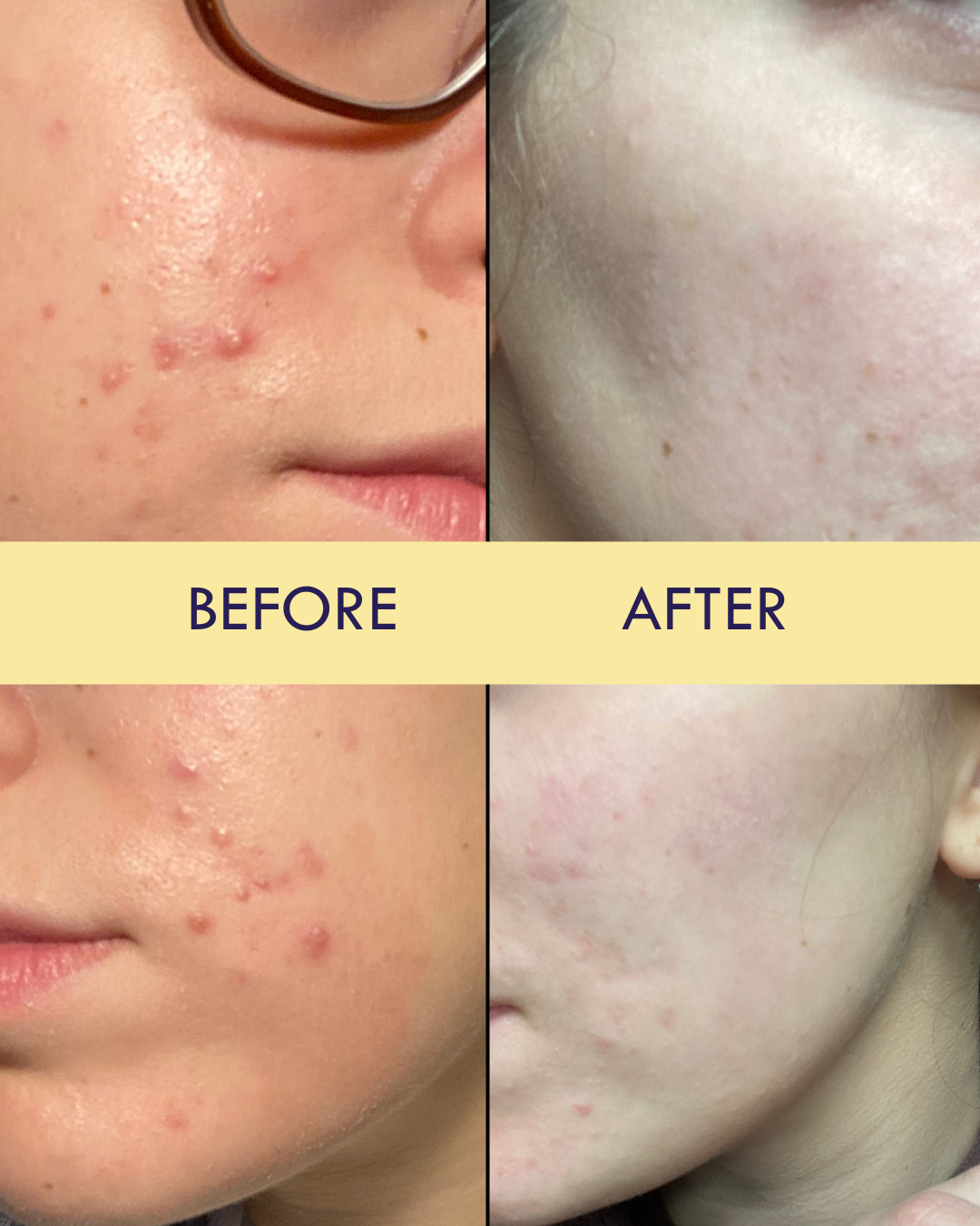 How JUVIA Transformed my Skin: Customer Testimonial