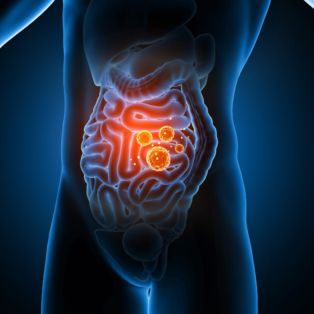 Different types of IBS