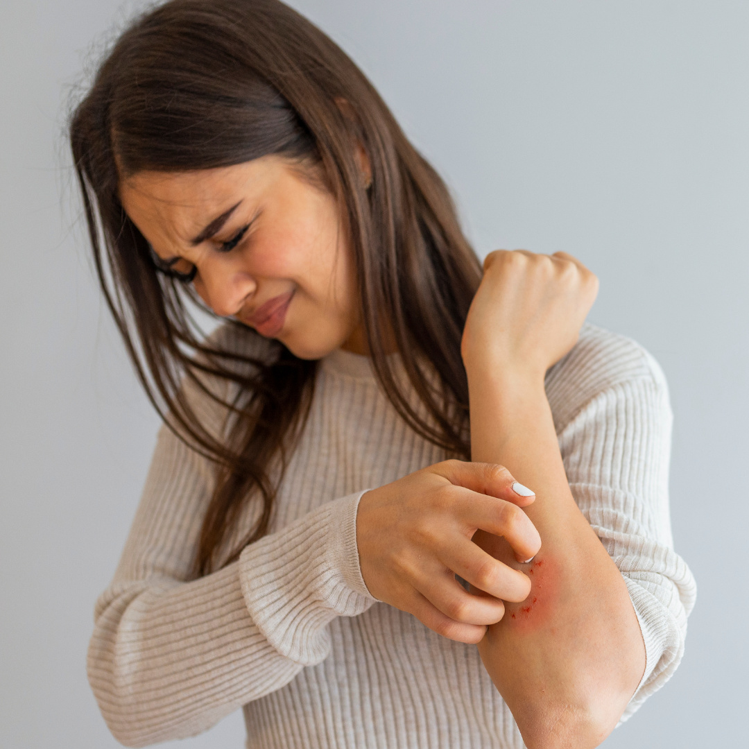 JUVIA and Eczema: How Gut Health Could Transform Your Skin